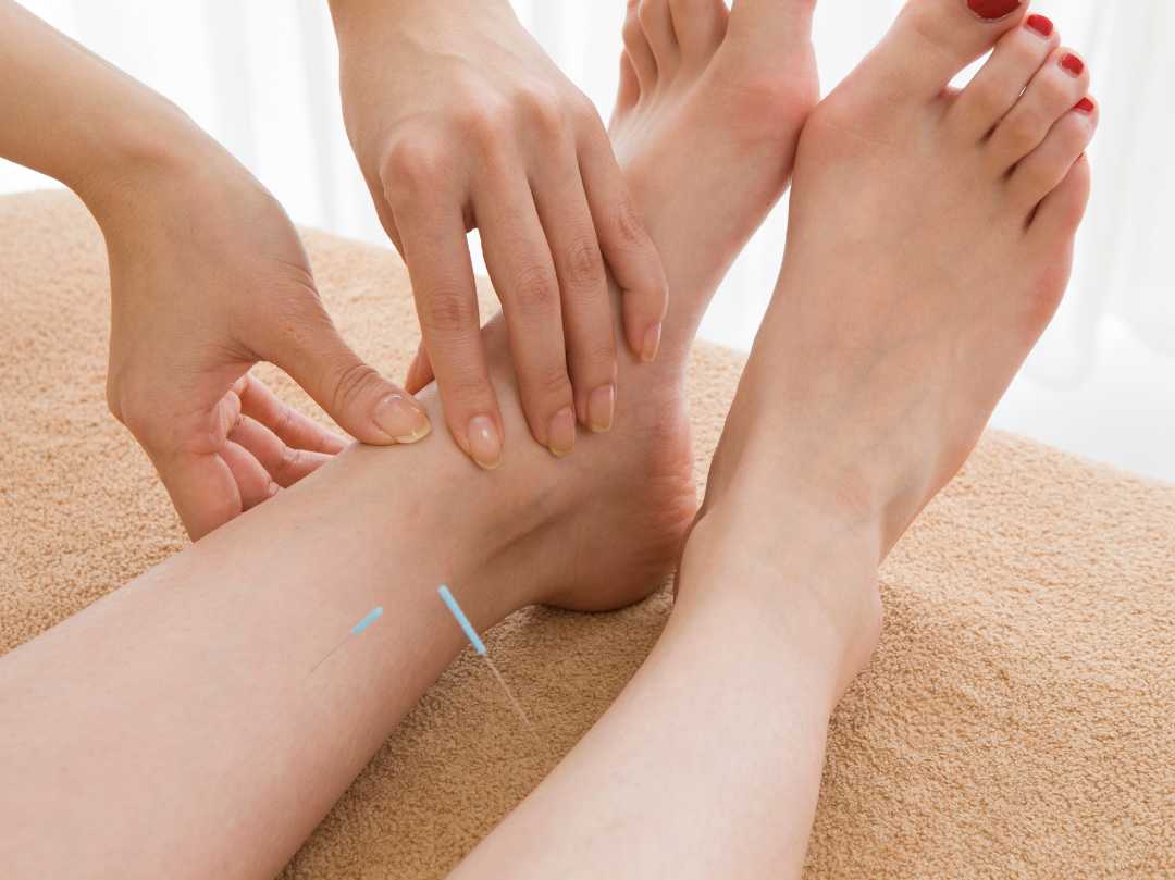 sprained ankle acupuncture