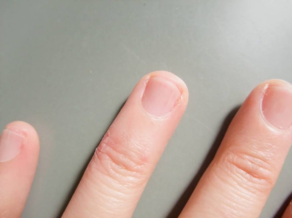 finger lunula