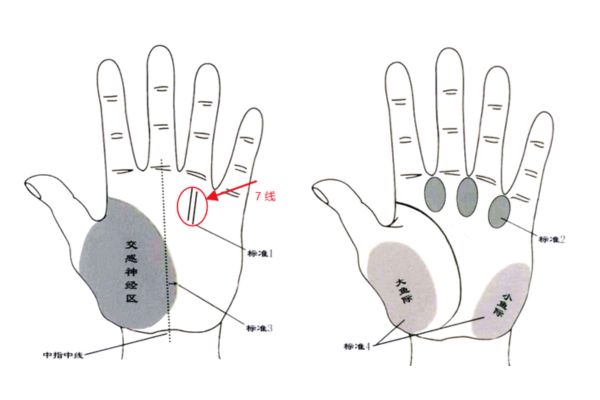 TCM High Blood Pressure