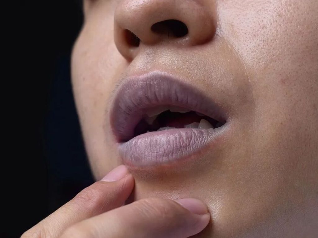 tcm lips