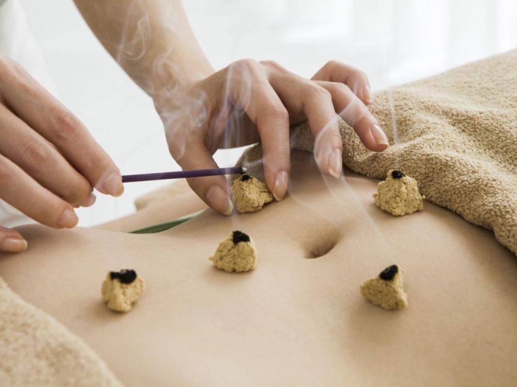 tcm moxibustion